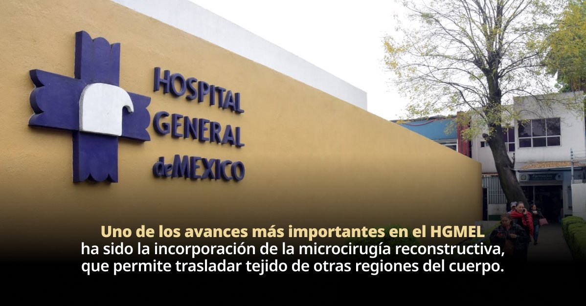 HGMEL refuerza reconstrucción mamaria permanente
