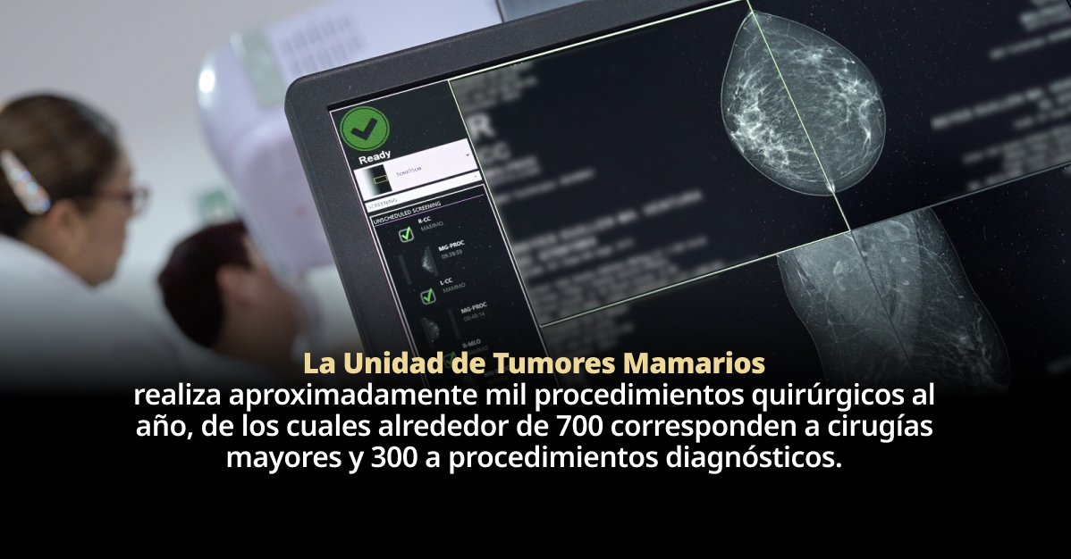 HGM optimiza atención a cáncer de mama