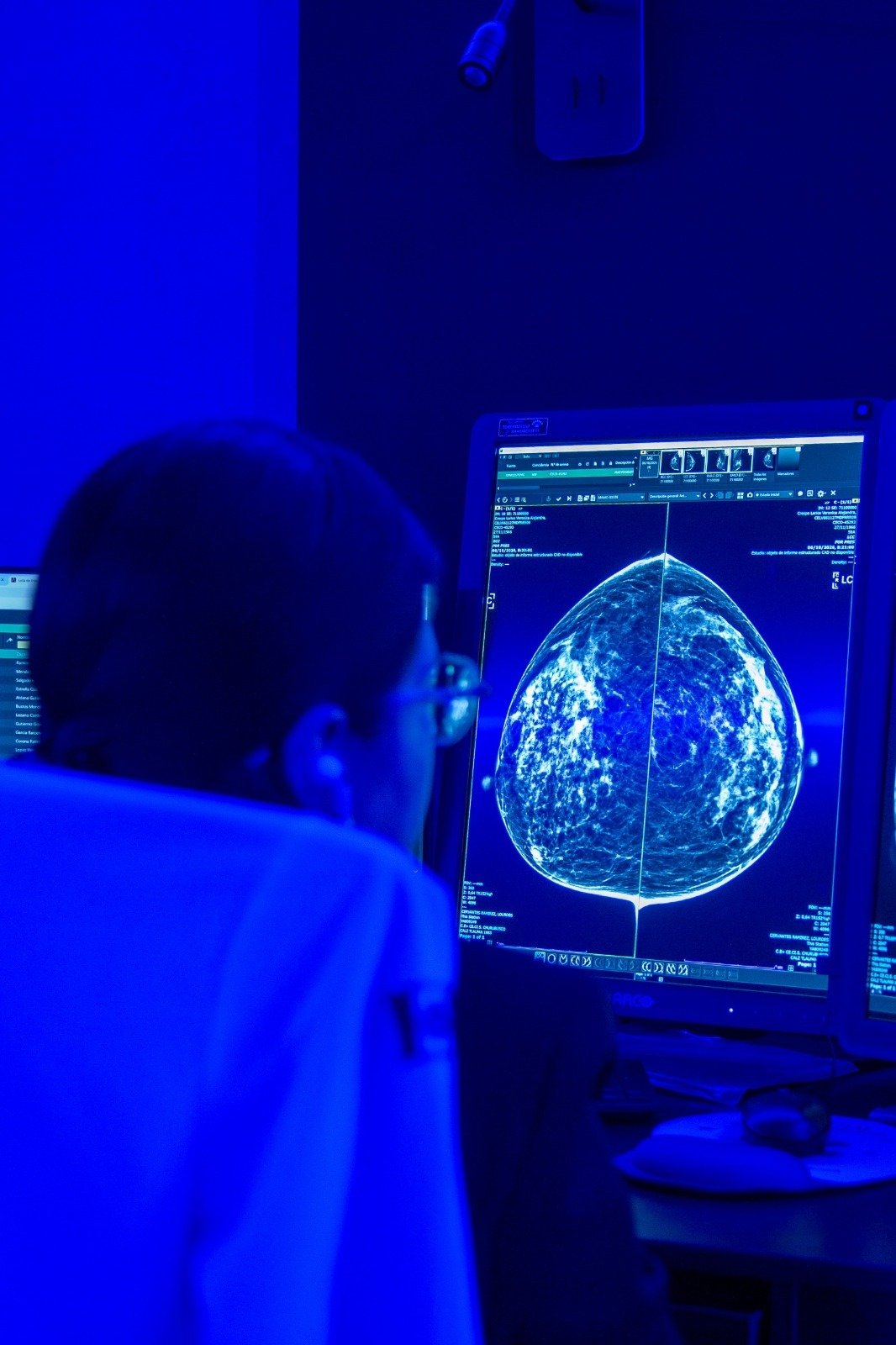 ISSSTE combate cáncer de mama con IA y robot (foto 7)